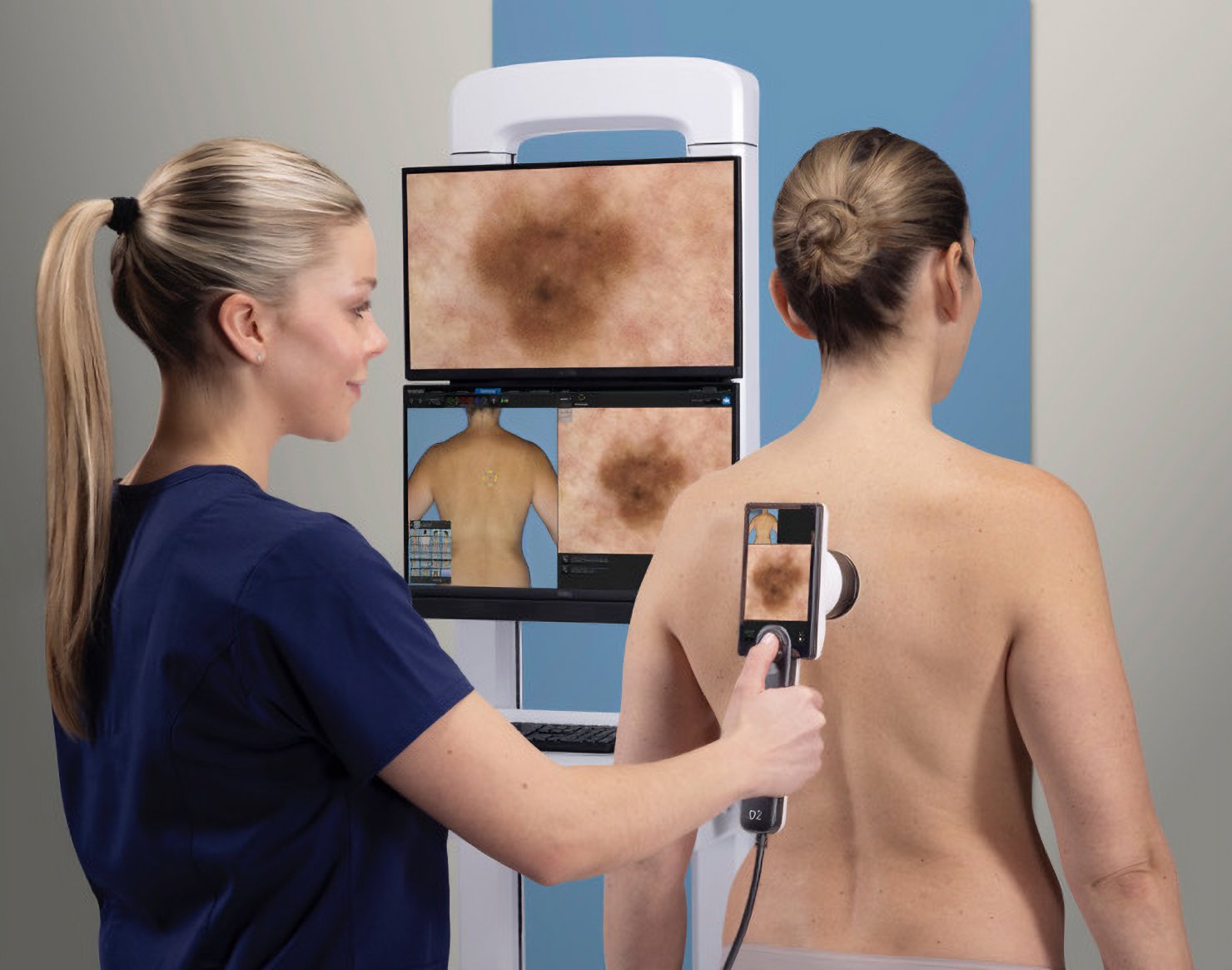 Total Body Mapping – intelligente Hautdokumentation mit KI